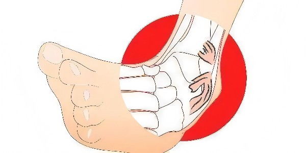 踝關(guān)節(jié)扭傷后的最佳應(yīng)對(duì)指南：簡(jiǎn)單四步，助力快速康復(fù)！